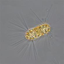 Corethron criophilum (Diatom)